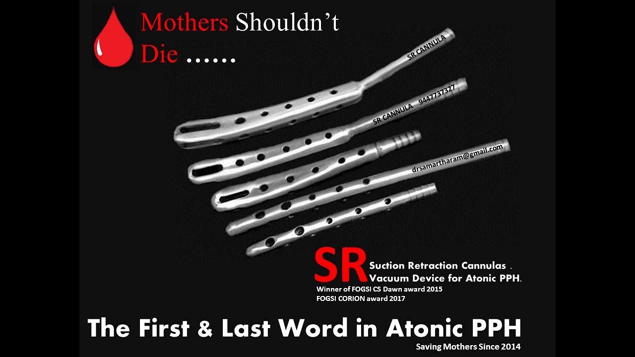 Postpartum Haemorrhage -SR Vacuum retraction Cannulas for Atonic PPH - Since 2013 . Animation