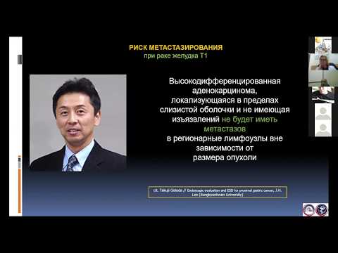 4. Перфильев, Пирогов. Ранний рак желудка с онкологических позиций: Не все то золото, что блестит