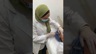 احدث تقنيه شد البشرة عالمياً جلسة السكلبترا Sculptra عند خبراء التجميل