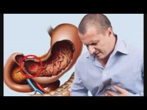 სსიპ ქალაქ თბილისის N61 საჯარო სკოლა ჯანსაღი ცხოვრება