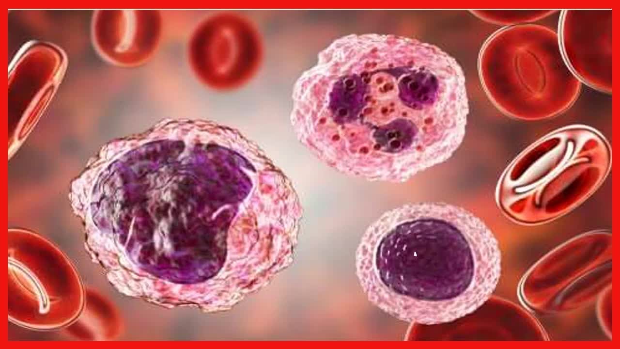 Taux élevé de monocytes dans le sang symptômes et traitements YouTube — free download