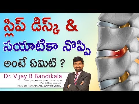 స్లిప్ డిస్క్ & సయాటికా నొప్పి అంటే ఏమిటి ? | Dr Vijay Bhaskar | Pain & Sleep Medicine | Hi9