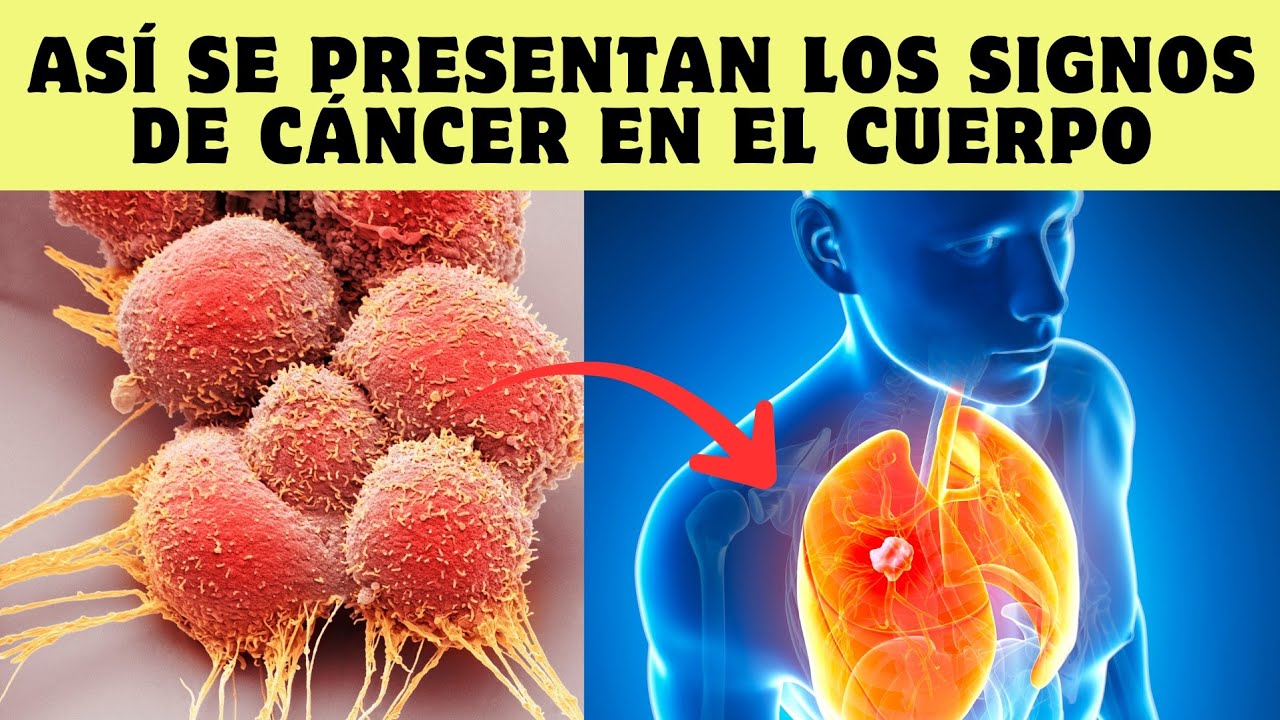 14 señales tempranas de cáncer que no debes ignorar