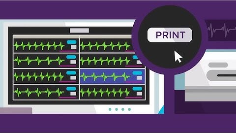 Automate Strip Export to Your EMR