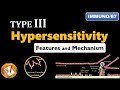 Type III Hypersensitivity Reactions: Main features and Mechanism (FL-Immuno/87)