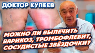 Можно ли вылечить варикоз, тромбофлебит, сосудистые звёздочки без операции: доктор Владимир Купеев