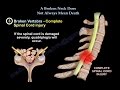 Cervical spine fracture,neck fracture - Everything You Need To Know - Dr. Nabil Ebraheim