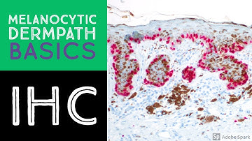 Melanocytic Dermpath Basics: Immunohistochemistry