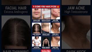 9 Silent Signs of Polycystic Ovary Syndrome Most Women Ignore 😳 (Check Now)