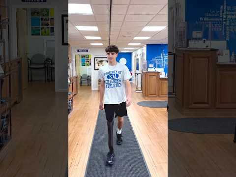 From First Prosthesis to College! 💪❤️ #AmputeeStrong #Inspiration