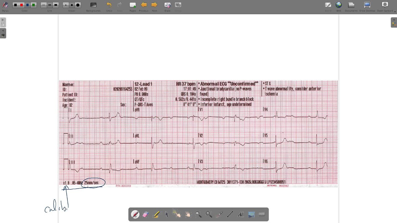 ecg paper youtube ekg graph paper