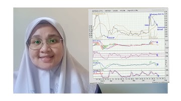 FIN 555-TECHNICAL ANALYSIS