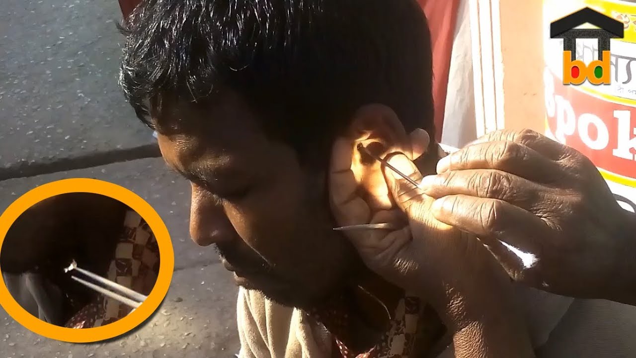 Village Guy Ear Cleaning at Street II Cheap Rated Ear Waxing BD II Dirt