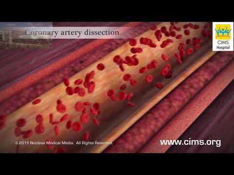 Acute Coronary Syndrome and Heart Attack (Hindi) - CIMS Hospital