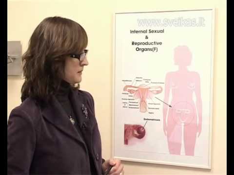 Video: Gleivinė Cista: Priežastys, Simptomai Ir Diagnozė