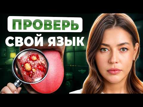 Your tongue SCREAMS about illness! / How to determine illness by the color of the tongue?