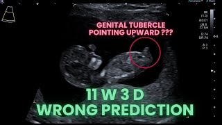 Ultrasound Pregnancy Wrong Gender prediction. WHY?