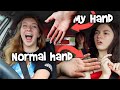 WHY ARE MY HANDS AGEING SO FAST? STRANGE DNA?? - Georgia Vlogs #1