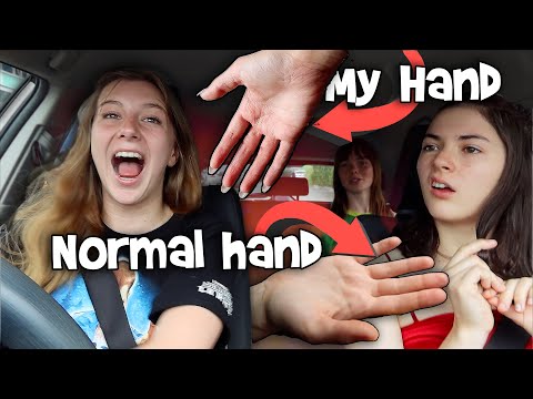 why-are-my-hands-ageing-so-fast?-strange-dna??---georgia-vlogs-#1