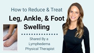 How to Treat Foot, Ankle, and Leg Lymphedema and Swelling - From a Lymphedema Therapist - NEW audio