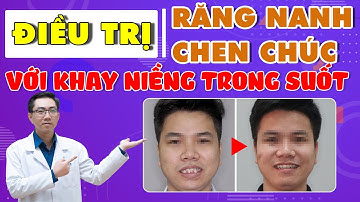Niềng Răng Điều Trị Chen Chúc - Răng Nanh Mọc Cao Với Khay Trong Suốt Vinalign | Nam Bùi Vinalign
