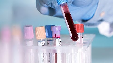 Pathology CPT codes Chemistry Part 2 - simplify medical coding