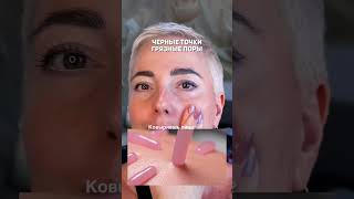Черные точки