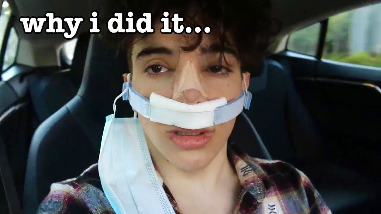 The Truth Behind My Nose Surgery | Nick Bencivengo