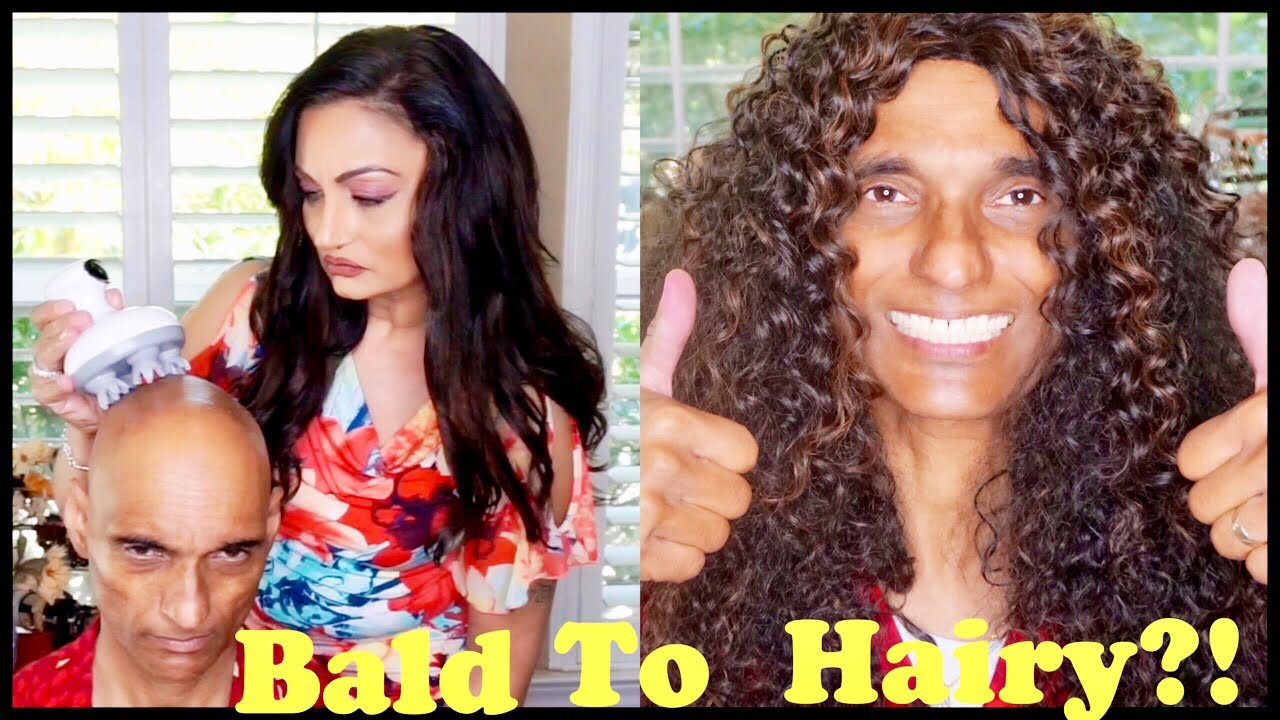 “MIRACLE HAIR GROWTH IN MINUTES” BALD TO A FULL HEAD OF HAIR YouTube