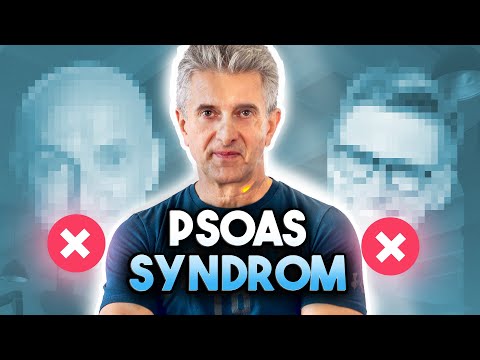 Video: Was ist das Iliopsoas-Syndrom?