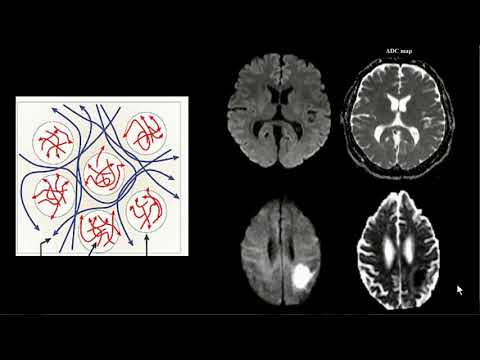 Vídeo: A Aquaporina 1 E O Cotransportador Na + / K + / 2Cl - 1 Estão Presentes Na Vasculatura Leptomeníngea Do Sistema Nervoso Central De Roedores Adultos