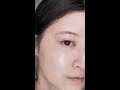 5時間かけて溶け出すニードルパッチが凄い