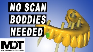 Exocad Design Tutorial for Screw retained Bar design on Ti Base implant abutment with Plovdiv 2.4