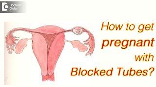 How can I get pregnant with blocked tubes? - Dr. Sunil Eshwar
