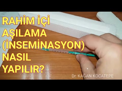 Rahim içi aşılama (inseminasyon) nasıl yapılır? - Sperm hazırlama, kanül ve sperm içeren enjektör