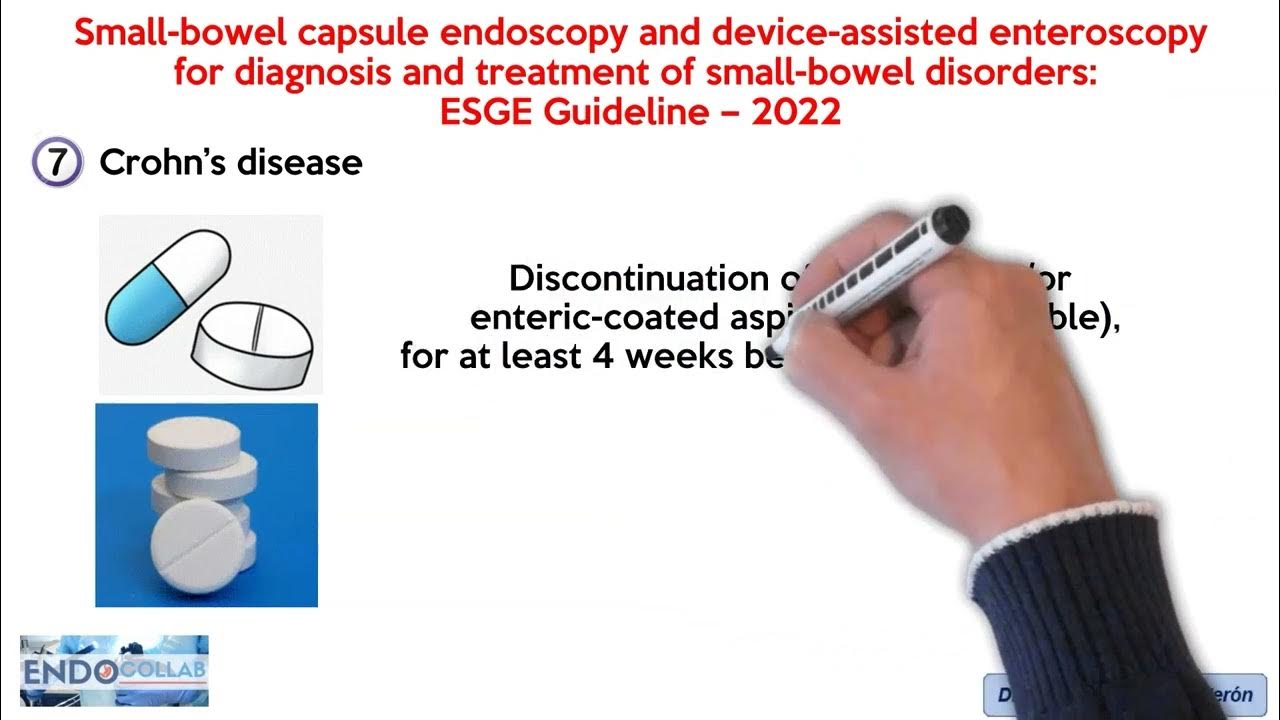 Smallbowel capsule endoscopy and enteroscopy for smallbowel disorders