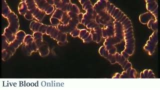 What Causes Red Blood Cells to Stick Together (rouleau) - Live Blood Analysis Training Course