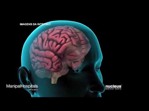 Os cuidados com a Fibromialgia