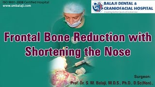 Frontal bone reduction with shortening the nose - Dr. S.M Balaji