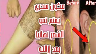 مكون سحري يمنع نمو الشعر في الجسم نهائيا بعد ازالته/الليزر المنزلي