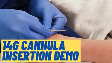Large (14G) cannula insertion technique - Live Demo