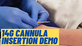 Large (14G) cannula insertion technique - Live Demo