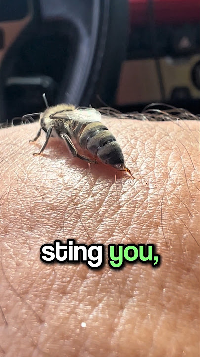 What Should You Do After a Bee Bites You? 🐝🤔