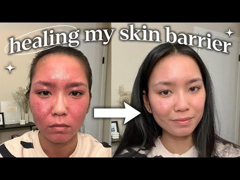 how i repaired my skin barrier (not sponsored)