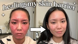 how i repaired my skin barrier (not sponsored)