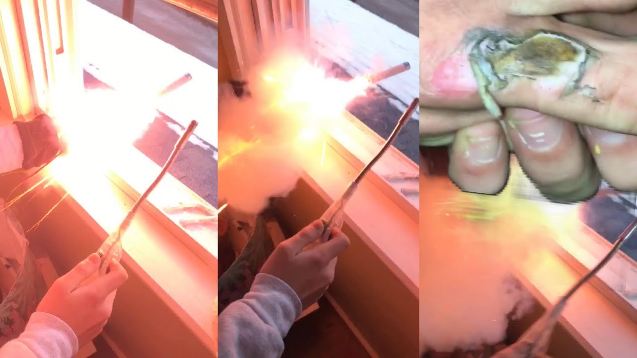 Blowing Up My Hand with Fireworks YouTube