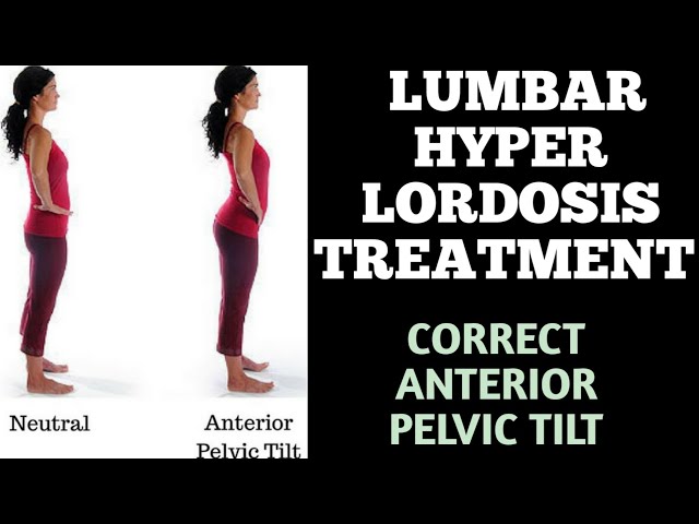 Swasti Yoga Center - If you have a deeper than normal curve in your lower  back (lumbar spine), it is called excessive lordosis. We have curated six yoga  poses that can help