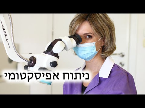 וִידֵאוֹ: מה כולל ניתוח מקרוסקופי?