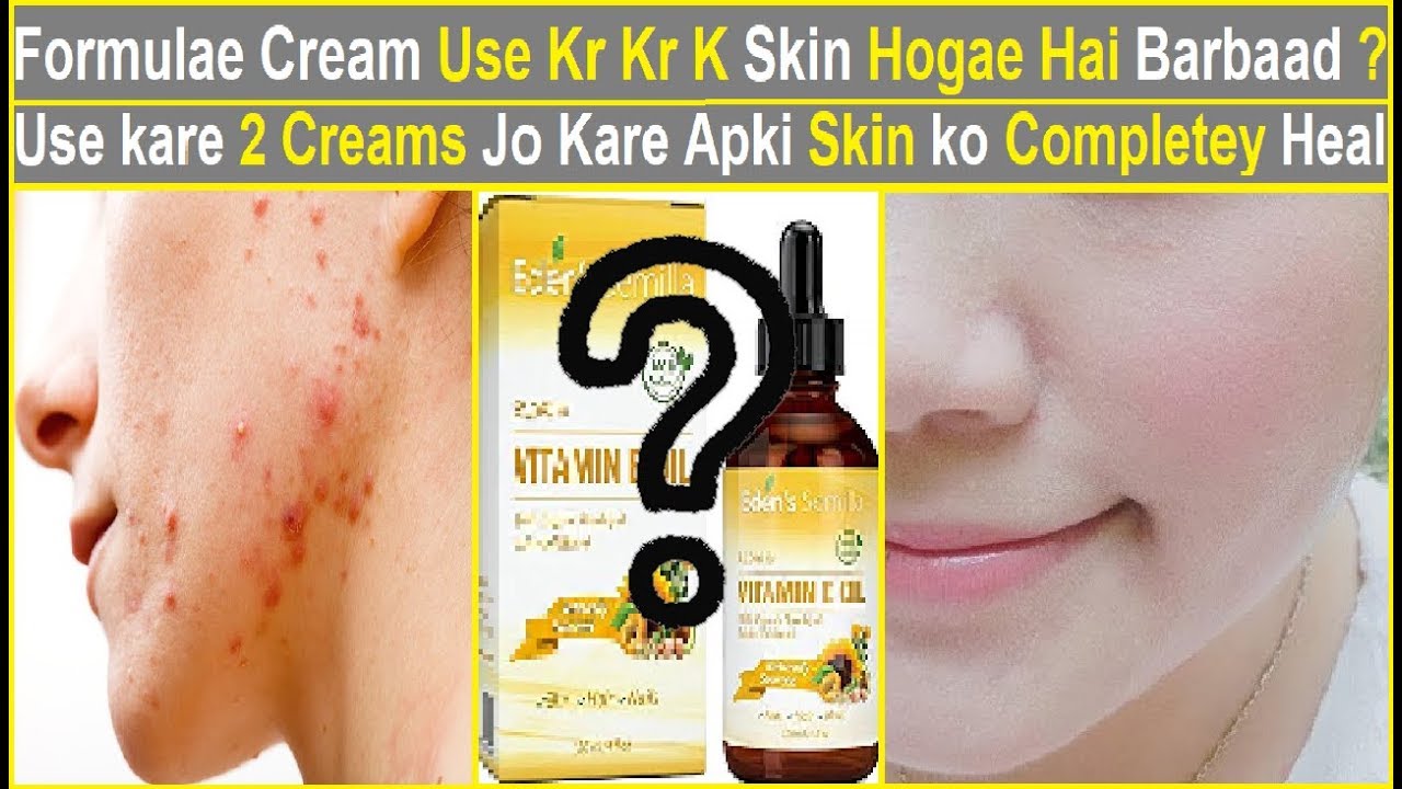 Best Healing Creams for Damage Skin due to Formula Creams YouTube