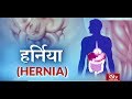 Ayushman Bhava:  Hernia | हर्निया | Symptoms and Cure